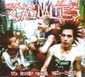 CASUALTIES / カジュアルティーズ / EARLY YEARS 1990-1995(DIGIPAK)