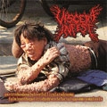 SPLIT (VISCERA INFEST / PARACCCCIDIODOMICOSISPROCTITISSARCOMUCOSIS) / SPLIT