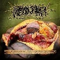 SPLIT (BOWEL STEW / HIPERMENORREA / PARACOCCIDIOIDOMICOSIS) / SPLIT