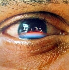 REDEYE / レッドアイ / REDEYE