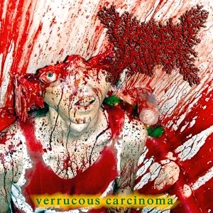 VISCERA INFEST / ヴィセラ・インフェスト / VERRUCOUS CARCINOMA