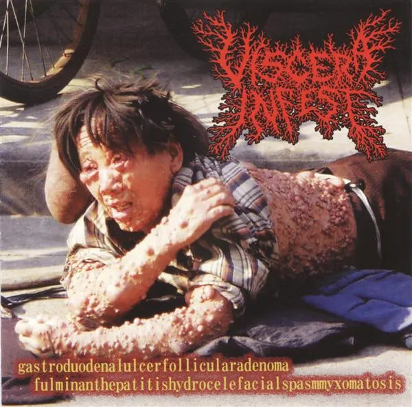 VISCERA INFEST / ヴィセラ・インフェスト / PARACOCCIDIODOMICOSISPROTITSSARCOMUCOSIS