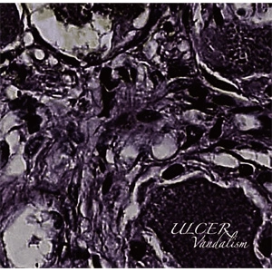 Ulcer (JPN/PUNK) / Vandalism