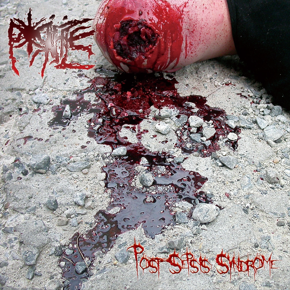 PORIFICE / ポリフィス / ポスト-セプシス･シンドローム / POST-SEPSIS SYNDROME
