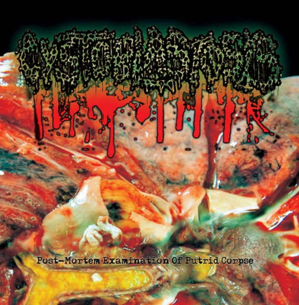 CYSTOBLASTOSIS / POST-MORTEM EXAMINATION OF PUTRID CORPSE