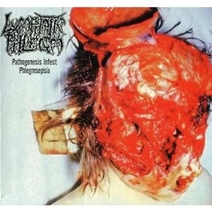 LYMPHATIC PHLEGM / PATHOGENESIS INFEST PHLEGMSEPSIA