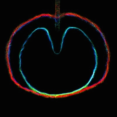 XTC / WASP STAR (APPLE VENUS VOL. 2) (200G LP)