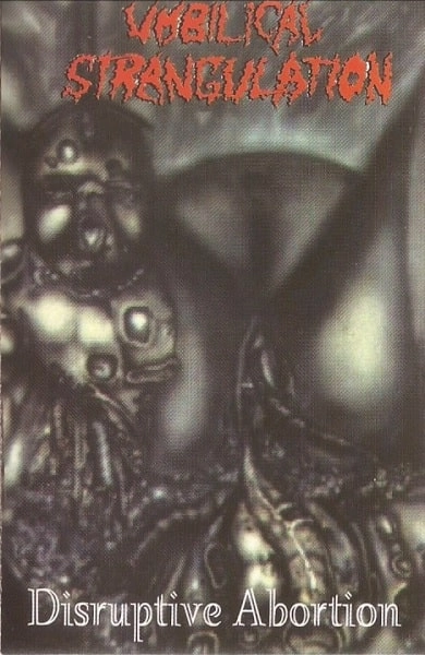 UMBILICAL STRANGULATION / DISRUPTIVE ABORTION