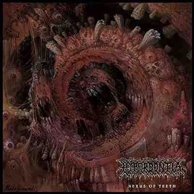 HYPERDONTIA / NEXUS OF TEETH