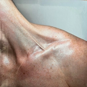 BENDIK GISKE / BENDIK GISKE