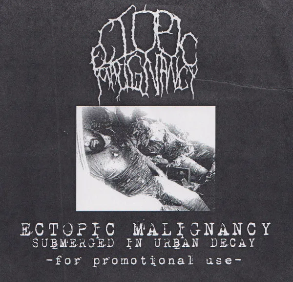 ECTOPIC MALIGNANCY / PROMO 2018