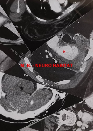 MAURIZIO BIANCHI (M.B.) / マウリツィオ・ビアンキ (M.B.) / NEURO HABITAT（CD-R）