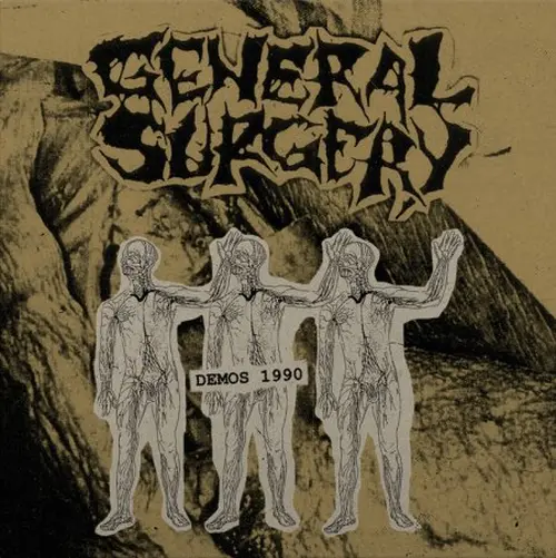 GENERAL SURGERY / ジェネラル・サージェリー / DEMOS 1990 (DIEHARD SNEEZED PUS SPLATTER VINYL (MARBLED GOLD-BROWN) + OBI STRIP)