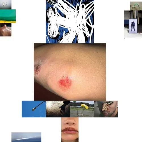 REMO HELFENSTEIN / SPITE